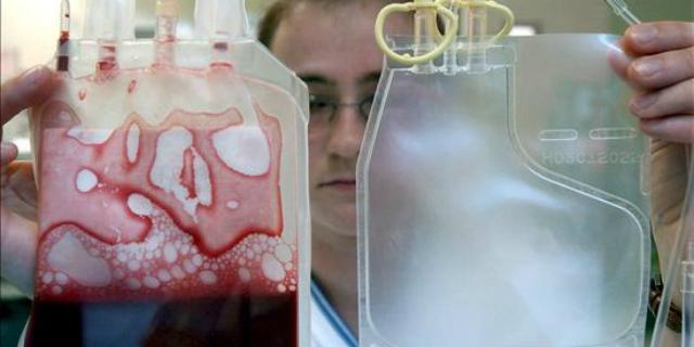 España inicia el primer ensayo clínico para inmunizar contra el VIH 