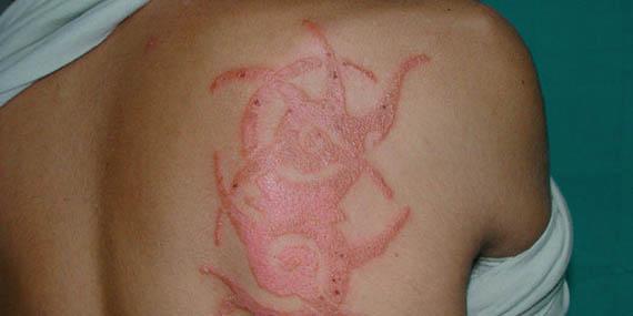 130716 peligros tatuajes henna