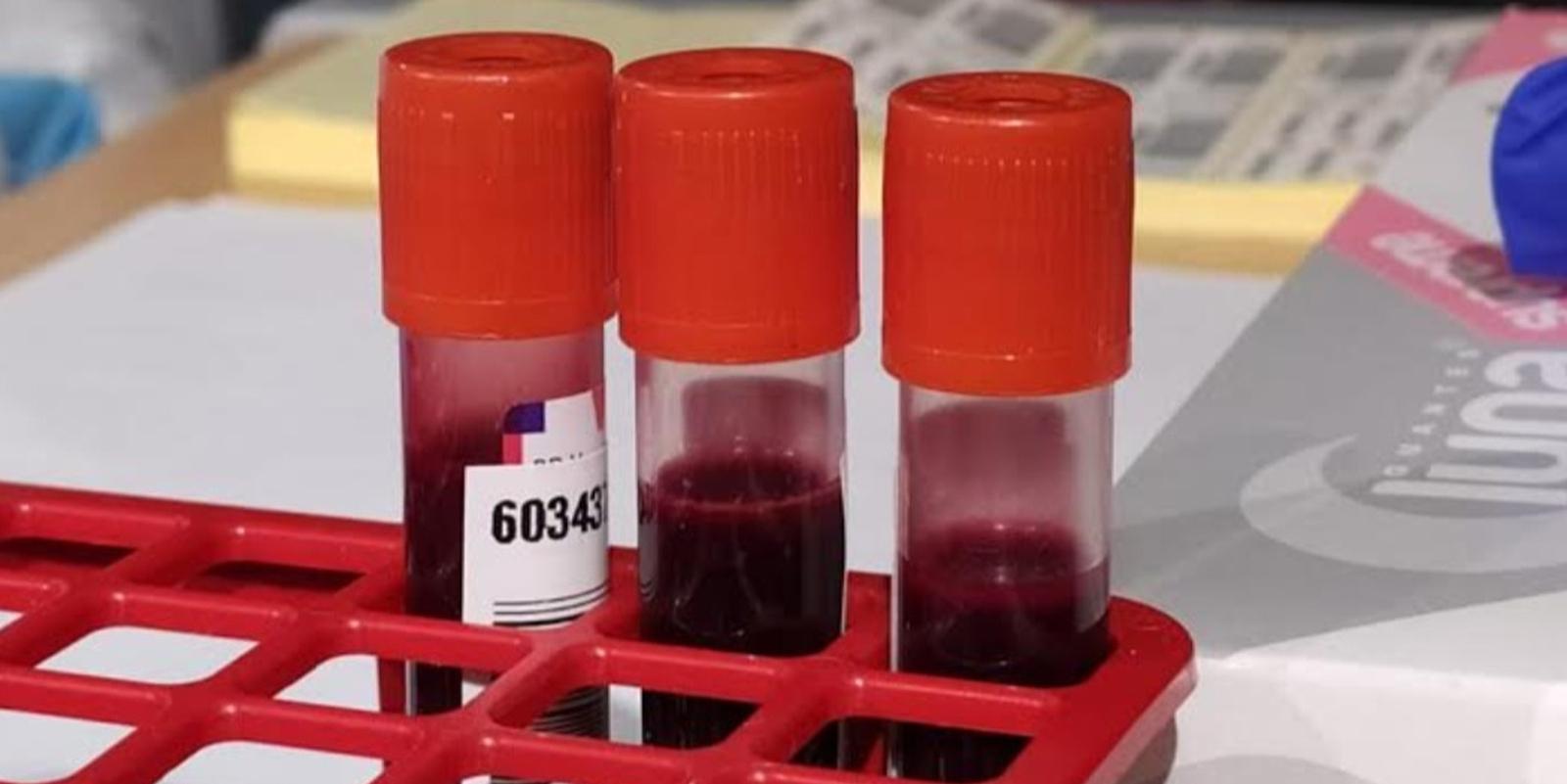 El 56,5% de los vecinos de Arroyomolinos se han sometido a la prueba de serología