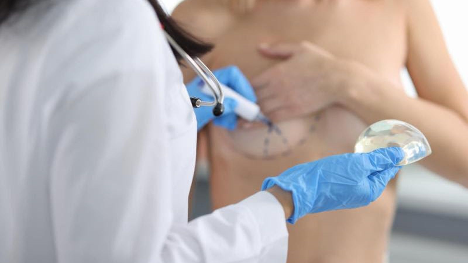 Por qué el "boom" de los retoques en España exige más que nunca recurrir a un cirujano de confianza