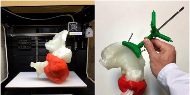 Cirugías más precisas y hasta un 40% más cortas gracias a impresoras 3D