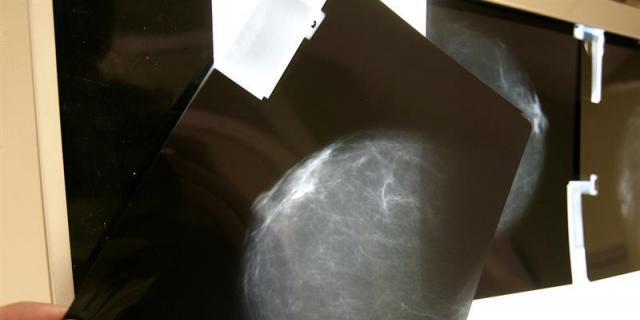 Las mamografías preventivas se realizarán en los hospitales públicos regionales