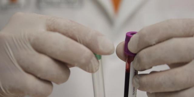 Hallan inmunofetipo en pacientes con VIH que ayudará a entender su deterioro inmunológico