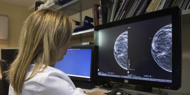 Investigadores de la UCM hallan nuevas proteínas para determinar la agresividad del tumor de mama