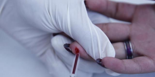 10.207 casos VIH diagnosticados esta década en Madrid