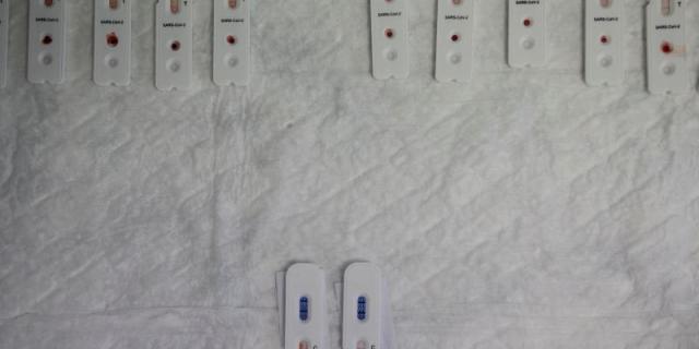 La Comunidad recogerá los resultados de los test de COVID-19 de los laboratorios privados