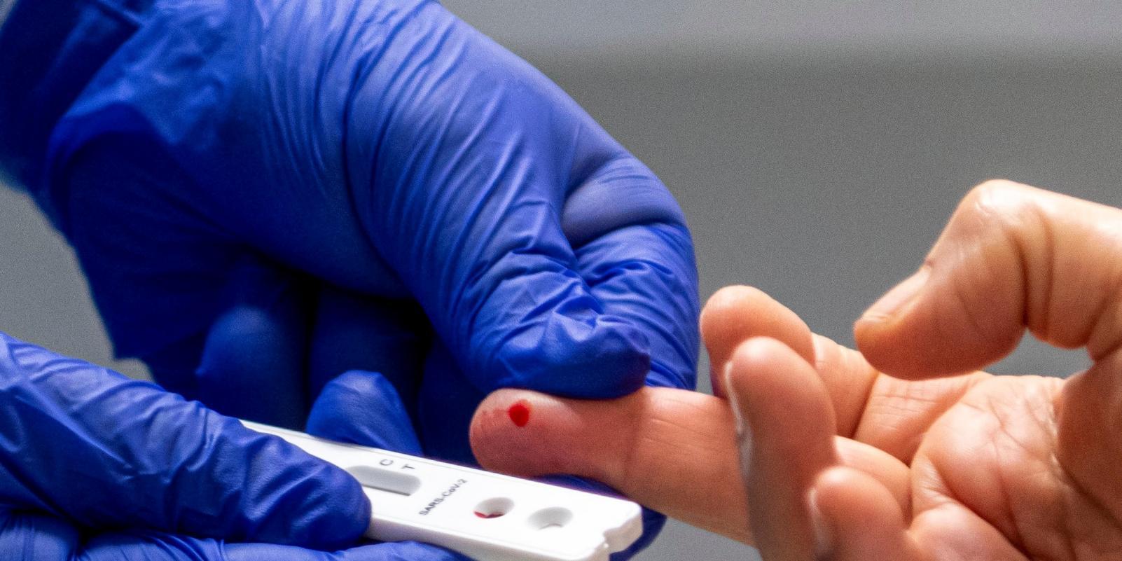 El Ministerio de Sanidad informa de 35 nuevos fallecidos con coronavirus en los últimos siete días