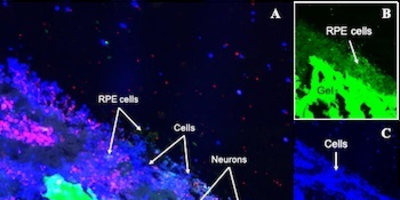 Construyen una retina artificial con seda para tratar una degeneración de la mácula