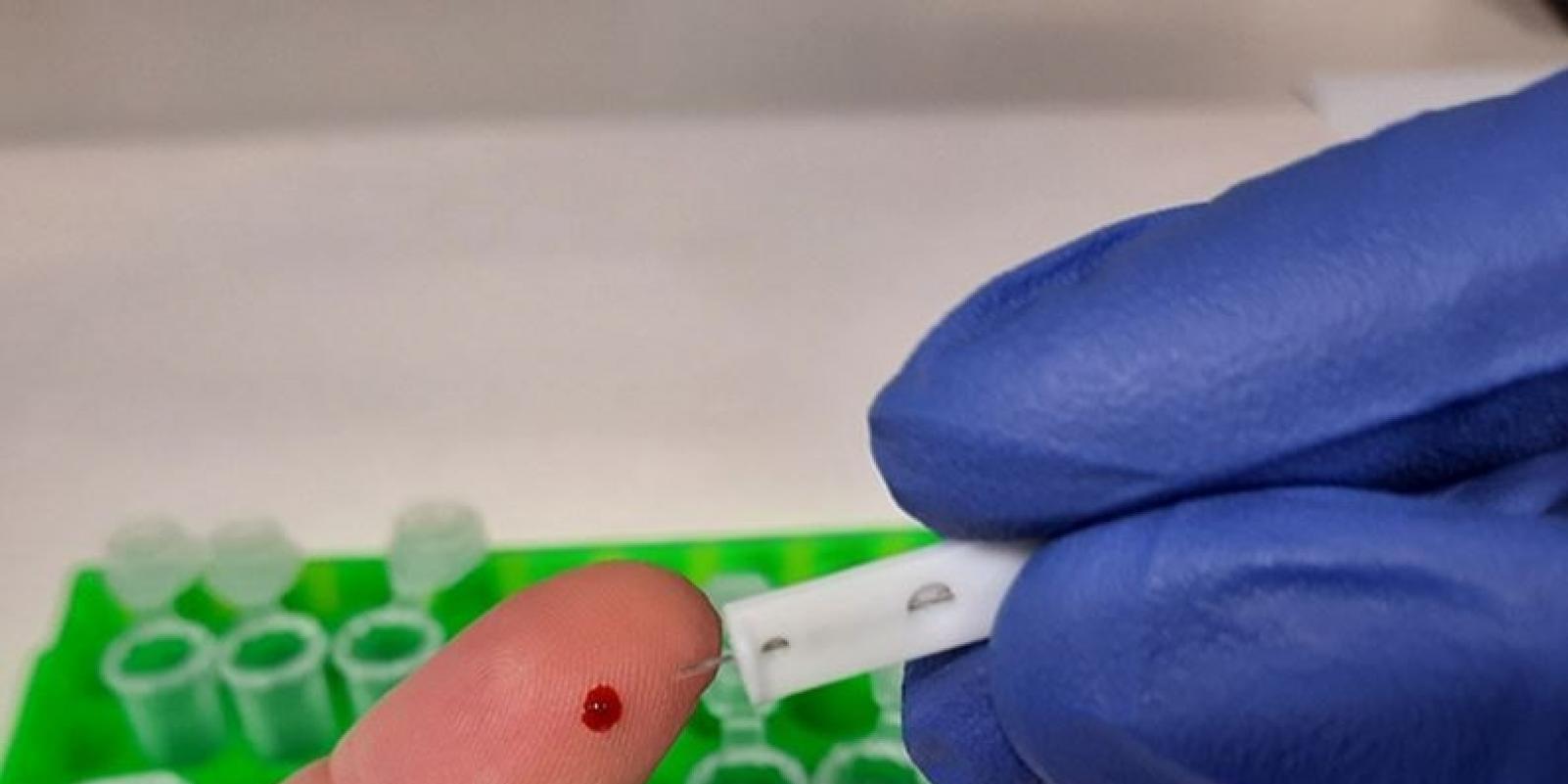 El CSIC diseña un test de anticuerpos para covid-19 más sensible y fiable al 99%