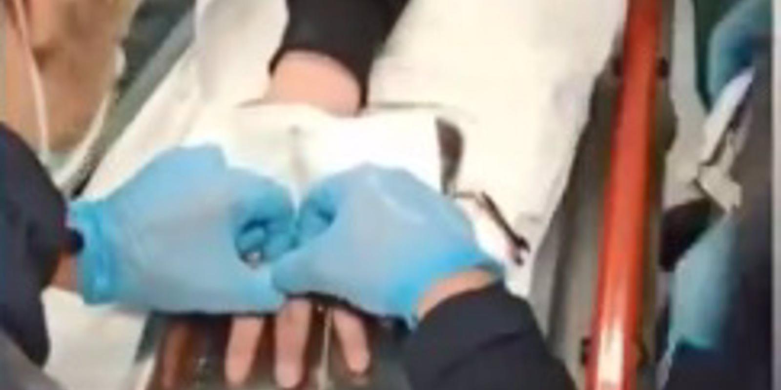 Bomberos sacan el anillo que quedó atascado en el dedo de un niño de 14 años