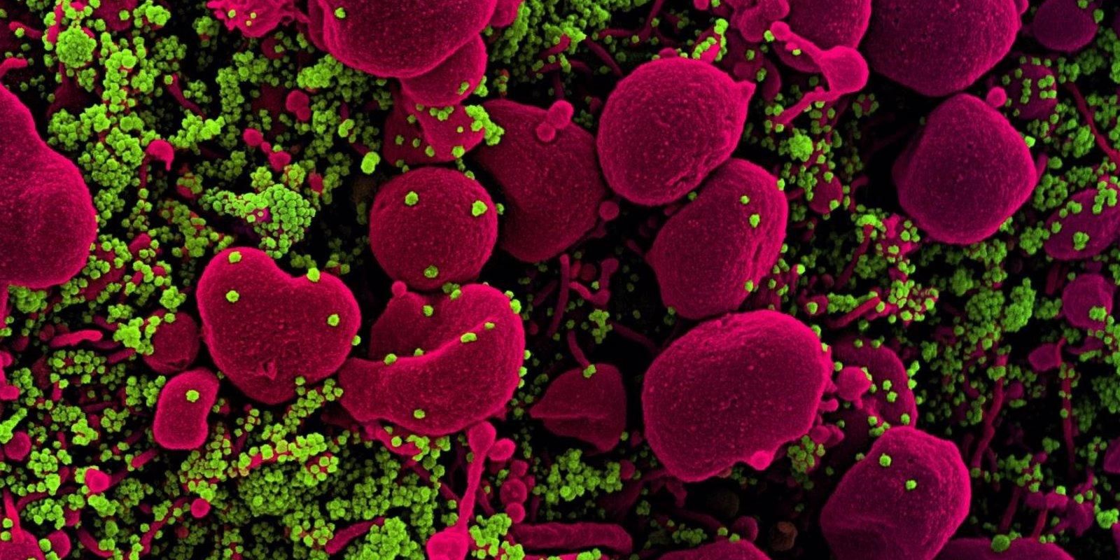 Un estudio apunta que la variante británica es un 45% más contagiosa que el virus original