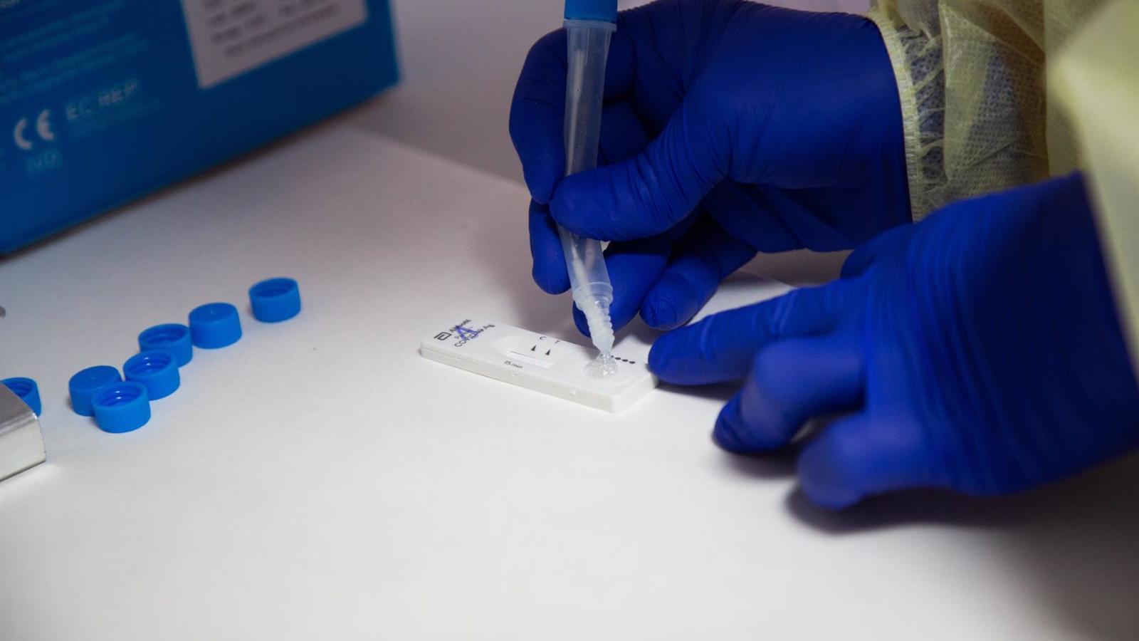 El Gobierno va a regular el precio de los test de antígenos