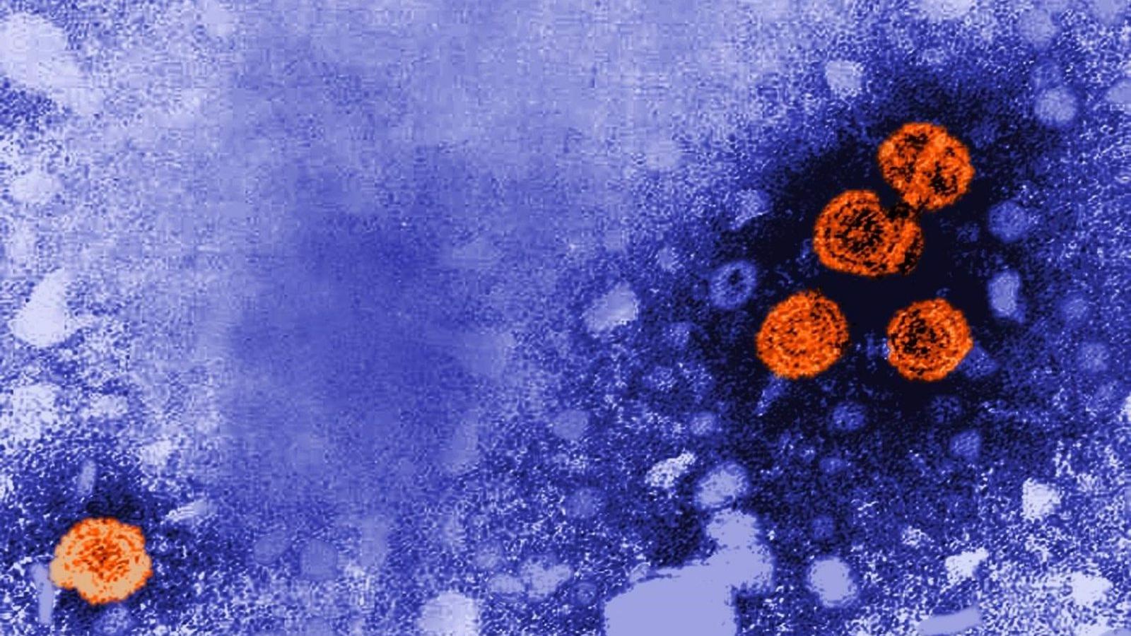 Investigan tres casos de hepatitis aguda de origen desconocido en niños
