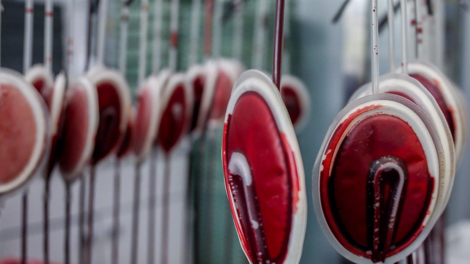 La Comunidad de Madrid organiza su quinto maratón solidario de donación de plasma