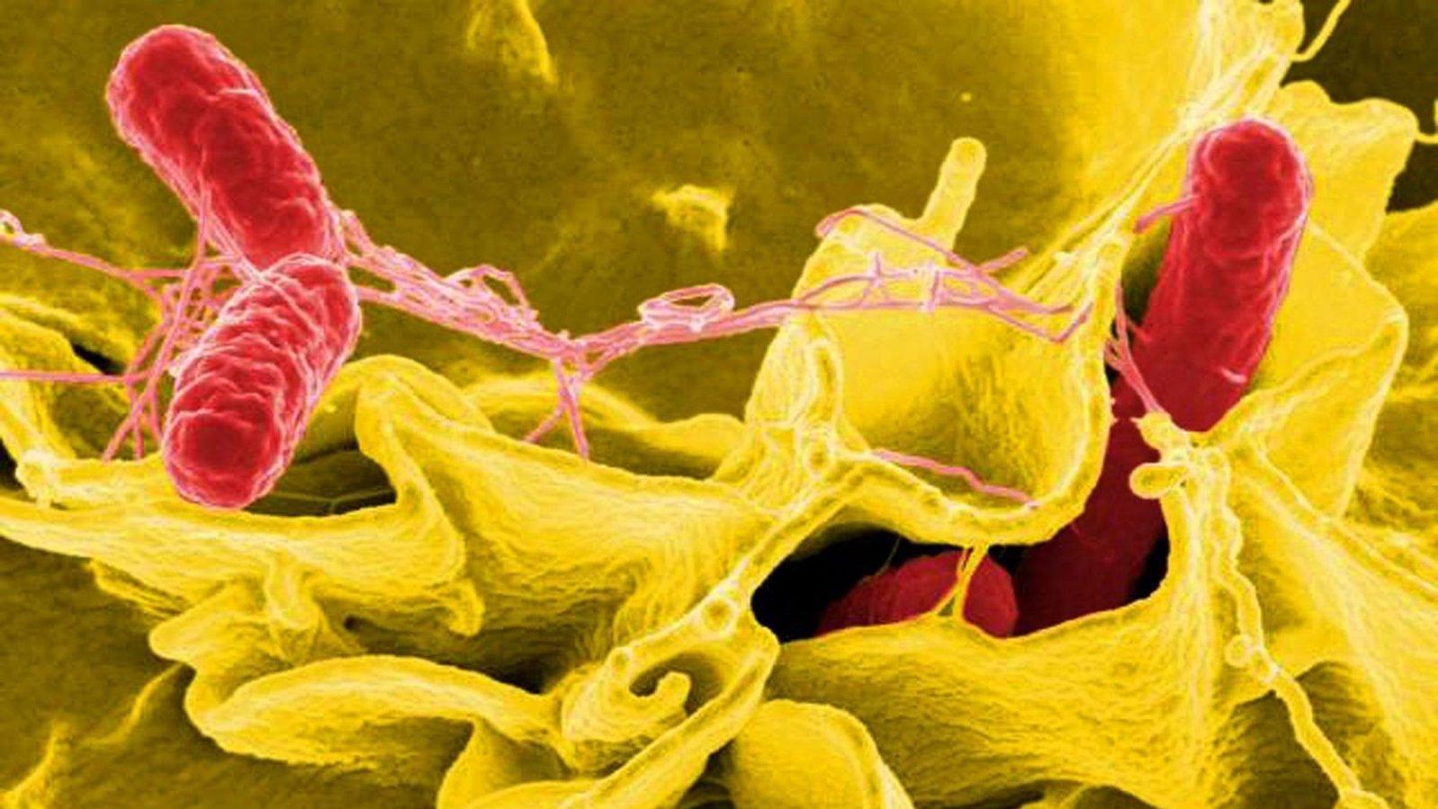 Un brote de salmonela afecta a 90 alumnos y docentes de un colegio de Hortaleza