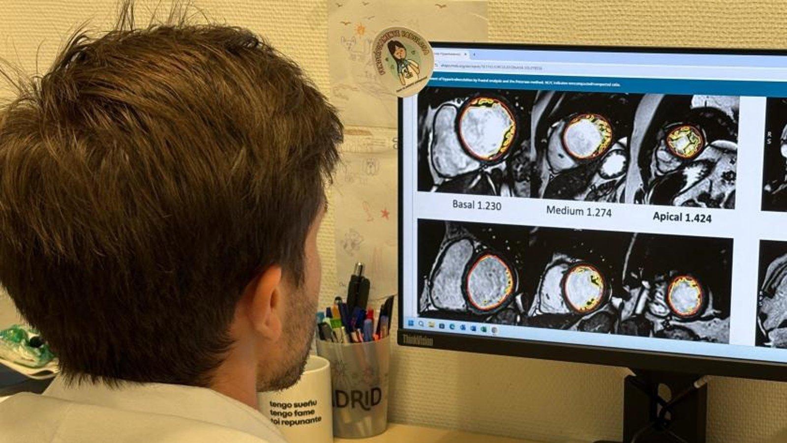El Puerta de Hierro participa en una investigación de cardiología El Puerta de Hierro participa en una investigación de cardiología