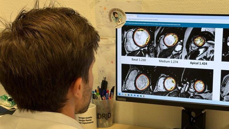 El Puerta de Hierro participa en una investigación de cardiología